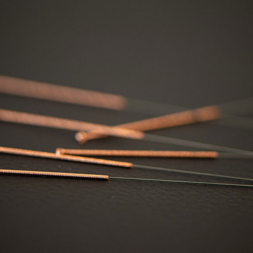 Reflow: Acupunctuur